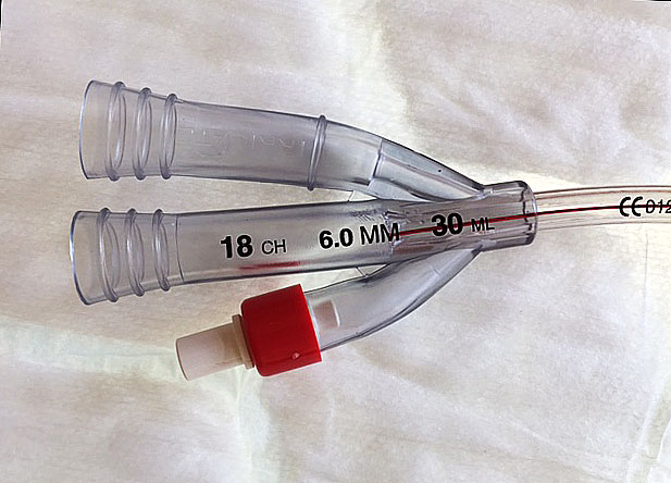 Catheters - catheter sizes
